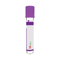 Non Vacuum Blood Collection Tube LMNV-C100